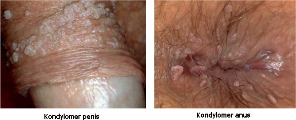anal sex guide sex med dværge anal sex guide sex med dværge